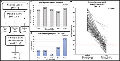 Intravascular Lithotripsy in Calcified Coronary Lesions: A Single-Center Experience in “Real-World” Patients